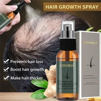 hot predaj 30ML Rast Vlasov Sprej Esenciálny Olej vypadávanie Vlasov Liquid Care Beauty Rast Vlasov Sprej pre Mužov, Ženy Starostlivosť o Vlasy Liečba